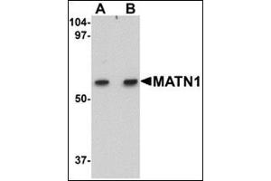 Western blot analysis of MATN1 in rat liver tissue lysate with this product at (A) 1 and (B) 2 μg/ml. (MATN1 Antikörper  (C-Term))