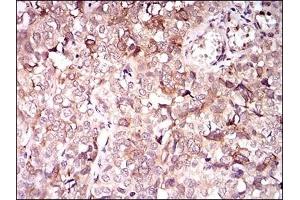 anti-Kinesin Family Member 11 (KIF11) antibody