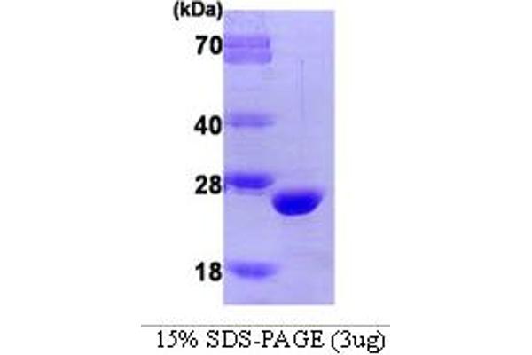 COMT Protein (AA 51-271)