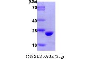 SDS-PAGE (SDS) image for Catechol-O-Methyltransferase (COMT) (AA 51-271) protein (ABIN666744) (COMT Protein (AA 51-271))