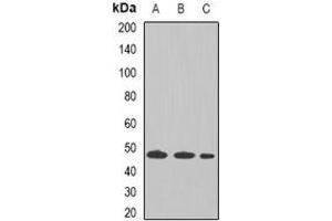 Western blot analysis of Tapasin expression in THP1 (A), Raji (B), mouse liver (C) whole cell lysates. (TAPBP Antikörper  (full length))