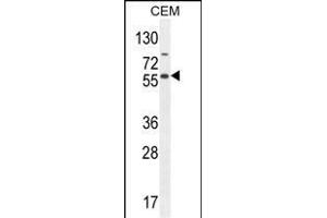 NFKBIL1 Antibody (Center) (ABIN654639 and ABIN2844336) western blot analysis in CEM cell line lysates (35 μg/lane). (NFKBIL1 Antikörper  (AA 256-285))