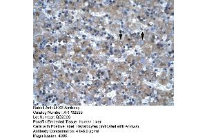 Rabbit Anti-LHX6 Antibody     Paraffin Embedded Tissue: Human Liver  Cellular Data: Hepatocytes  Antibody Concentration: 4.