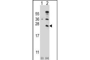 Western blot analysis of CD3E (arrow) using rabbit polyclonal CD3E Antibody (C-term) (ABIN657454 and ABIN2846481). (CD3 epsilon Antikörper  (C-Term))