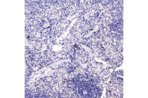 IHC analysis of HE4 using anti-HE4 antibody (ABIN5693137). (WFDC2 Antikörper  (AA 31-124))