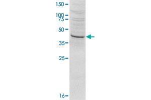 Western blot was performed on HeLa nuclear extract (HeLa NE, 20 ug) using SETD8 polyclonal antibody  at dilution 1 : 1000 in TBS-Tween + 5% skimmed milk. (SETD8 Antikörper  (N-Term))