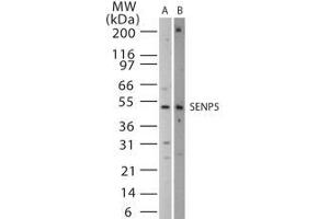 Image no. 1 for anti-SUMO1/sentrin Specific Peptidase 5 (SENP5) (AA 229-246) antibody (ABIN208763) (SENP5 Antikörper  (AA 229-246))