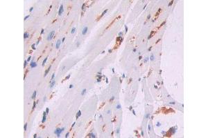 Used in DAB staining on fromalin fixed paraffin- embedded heart tissue (CCRK Antikörper  (AA 4-288))