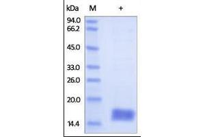 Human Cystatin SA, His Tag on SDS-PAGE under reducing (R) condition. (CST2 Protein (AA 21-141) (His tag))