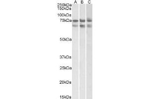 ABIN2613433 (2µg/ml) staining of HeLa (A)HepG2 (B) and K562 (C) nuclear lysates (35µg protein in RIPA buffer). (Nucleostemin Antikörper  (Internal Region))