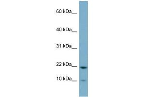 WB Suggested Anti-D15Wsu75e Antibody Titration:  0. (DESI1 Antikörper  (Middle Region))