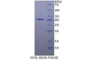 SDS-PAGE (SDS) image for Prostaglandin E Receptor 2 (Subtype EP2), 53kDa (PTGER2) (AA 155-355) protein (His tag) (ABIN1879089)