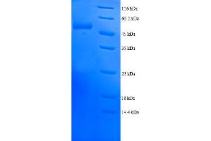 SDS-PAGE (SDS) image for Proteasome (Prosome, Macropain) Subunit, beta Type, 4 (PSMB4) (AA 46-264) protein (GST tag) (ABIN5712141)