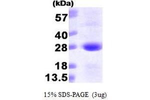 SDS-PAGE (SDS) image for SAR1 Homolog A (SAR1A) (AA 1-198) protein (His tag) (ABIN667120) (SAR1A Protein (AA 1-198) (His tag))