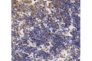 Immunohistochemistry (Paraffin-embedded Sections) (IHC (p)) image for anti-Myeloid/lymphoid Or Mixed-Lineage Leukemia (Trithorax Homolog), Translocated To, 11 (MLLT11) antibody (ABIN7074715)
