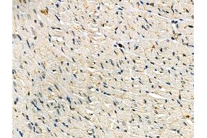 Phospho-NFAT5 (Ser155) Antibody at 1/100 staining Rat heart tissue by IHC-P.