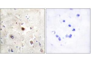 Immunohistochemistry analysis of paraffin-embedded human brain tissue, using p57KIP2 antibody. (CDKN1C Antikörper  (N-Term))