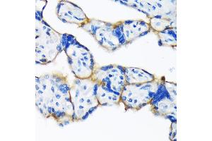Immunohistochemistry of paraffin-embedded human placenta using Dysferlin (Romeo) Rabbit mAb (ABIN7266868) at dilution of 1:100 (40x lens). (Dysferlin Antikörper)