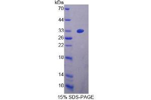 SDS-PAGE analysis of Mouse ZRF1 Protein. (DNAJC2 Protein)