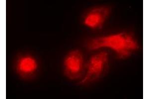 Immunofluorescent analysis of LKB1 staining in A431 cells. (LKB1 Antikörper  (C-Term))