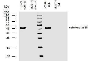Western blotting analysis of human cytokeratin 18 using mouse monoclonal antibody C-04 on lysates of HT-29 cell line and MOLT-4 cell line (cytokeratin non-expressing cell line, negative control) under non-reducing and reducing conditions.