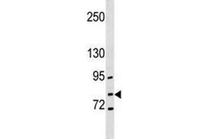 GCLC antibody western blot analysis in NCI-H292 lysate (GCLC Antikörper  (AA 286-315))