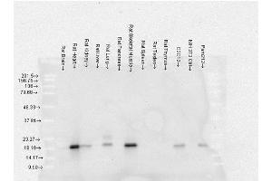Western Blot analysis of Rat Brain, Heart, Kidney, Liver, Pancreas, Skeletal muscle, Spleen, Testes, Thymus cell lysates showing detection of Alpha B Crystallin protein using Mouse Anti-Alpha B Crystallin Monoclonal Antibody, Clone 3A10. (CRYAB Antikörper  (Biotin))
