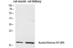 Western Blot analysis of rat musle (1), rat kidney (2), diluted at 1:2000.