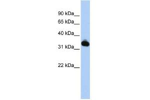 WB Suggested Anti-GALM Antibody Titration: 0. (GALM Antikörper  (N-Term))