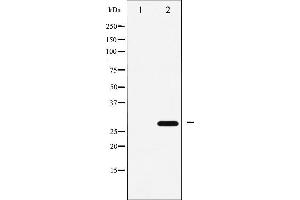 Western blot analysis of p27 Kip1 expression in EGF treated HeLa whole cell lysates,The lane on the left is treated with the antigen-specific peptide. (CDKN1B Antikörper  (C-Term))