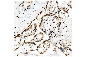 IHC analysis of KAP1/TRIM28 using anti-KAP1/TRIM28 antibody (ABIN7602310).