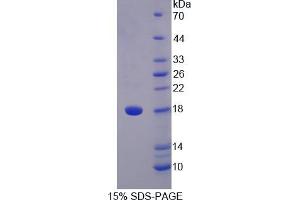 SDS-PAGE analysis of Human STAT5A Protein. (STAT5A Protein)