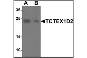Western blot analysis of TCTEX1D2 in K562 cell lysate with TCTEX1D2at 1 ug/mL in (A) the absence and (B) the presence of blocking peptide. (TCTEX1D2 Antikörper  (N-Term))