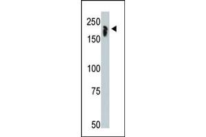 NCOR1 Antikörper  (N-Term)