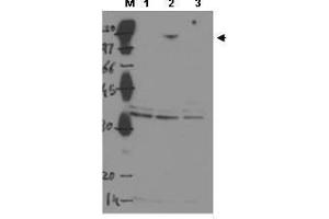 Western blot using  Protein A purified anti-ASPP2 to detect over-expressed ASPP2 in MCF-7 cells (Lane 2, arrowhead). (TP53BP2 Antikörper  (Internal Region))