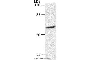 Western blot analysis of 231 cell, using SLC16A4 Polyclonal Antibody at dilution of 1:1200 (SLC16A4 Antikörper)