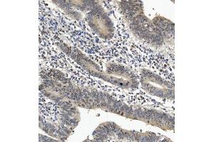 IHC analysis of EYA4 using anti-EYA4 antibody (ABIN7601063). (EYA4 Antikörper  (AA 28-205))