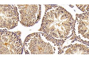 Immunohistochemistry (IHC) image for anti-Nuclear Receptor Subfamily 0, Group B, Member 1 (NR0B1) (AA 1-227) antibody (ABIN7445369)