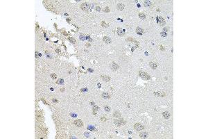 Immunohistochemistry of paraffin-embedded mouse brain using PKN1 antibody at dilution of 1:100 (x40 lens).