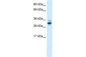 Western Blotting (WB) image for anti-Zinc Finger Protein 654 (ZNF654) antibody (ABIN2460661) (ZNF654 Antikörper)