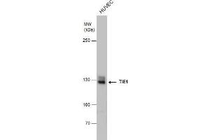 WB Image TIE1 antibody detects TIE1 protein by western blot analysis. (TIE1 Antikörper)