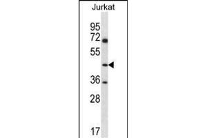 ASS1 Antibody (C-term) (ABIN656537 and ABIN2845801) western blot analysis in Jurkat cell line lysates (35 μg/lane). (ASS1 Antikörper  (C-Term))