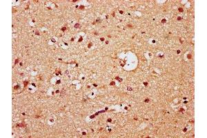 IHC image of ABIN7172459 diluted at 1:300 and staining in paraffin-embedded human brain tissue performed on a Leica BondTM system. (HNF1B Antikörper  (AA 539-704))