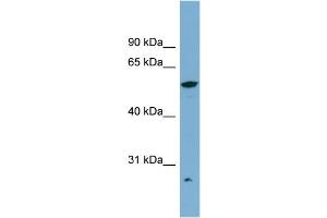 WB Suggested Anti-ALDH3A2 Antibody Titration:  0. (ALDH3A2 Antikörper  (Middle Region))