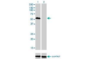 Western blot analysis of FOXA1 over-expressed 293 cell line, cotransfected with FOXA1 Validated Chimera RNAi (Lane 2) or non-transfected control (Lane 1).