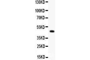 Western Blotting (WB) image for anti-Purinergic Receptor P2X, Ligand-Gated Ion Channel, 5 (P2RX5) (AA 333-422) antibody (ABIN3043894)