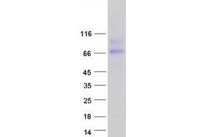 Western Blotting (WB) image for HEPACAM Family Member 2 (HEPACAM2) (Transcript Variant 1) protein (Myc-DYKDDDDK Tag) (ABIN2722621)
