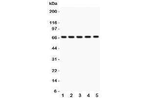 Western blot testing of HNF1A antibody and Lane 1:  rat liver (HNF1A Antikörper  (AA 431-631))