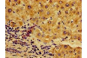 Immunohistochemistry of paraffin-embedded human liver tissue using ABIN7161777 at dilution of 1:100 (NFKB2 Antikörper  (AA 263-439))