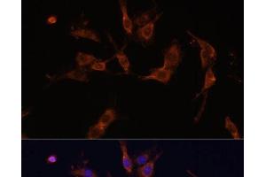 Immunofluorescence analysis of C6 cells using IQGAP1 Polyclonal Antibody at dilution of 1:100 (40x lens). (IQGAP1 Antikörper)